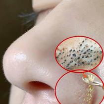 (Small Red Book Recommended) Clean facial garbage deep removal of dirt shrink pores tear face mask