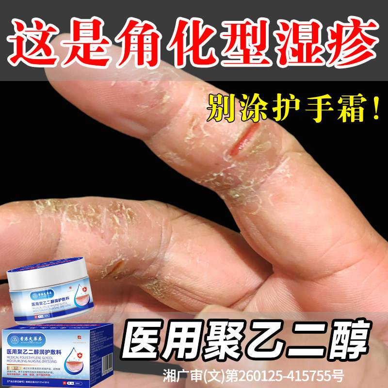 反复脱皮用什么护肤品？COSLXIU角化型修复霜58元解决手足干裂问题_护肤