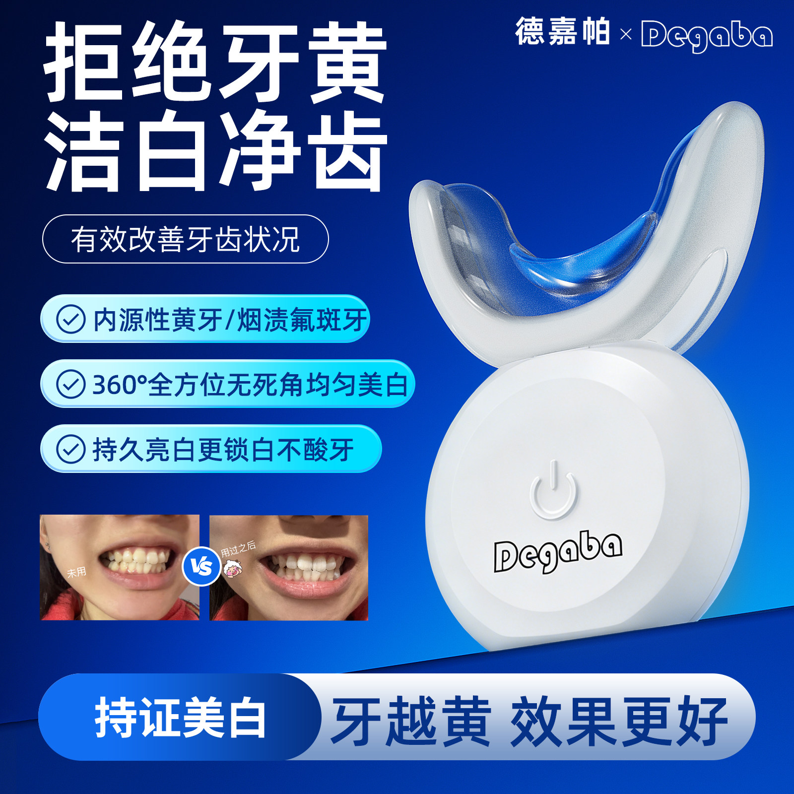 蓝光牙齿美白仪-蓝光牙齿美白仪促销价格、蓝光牙齿美白仪品牌- 淘宝