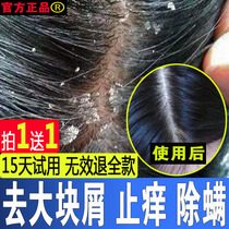 Anti-dandruff artifact anti-dandruff anti-itching shampoo Medicine Kangwang serious men and women special anti-dandruff oil control shampoo