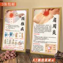 Shoulder periarthritis poster cervical spondylosis lumbar disc wall chart bone hyperplasia wall stickers fasciitis spondylitis posters