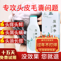 Professional anti-dandruff and itching shampoo to remove dandruff and dandruff artifact to remove mites