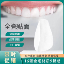 Yiwon Jiaquan porcelain veneered tooth porcelain patch manufacturer full porcelain tooth veneered whitening import ultra-thin ceramic patch