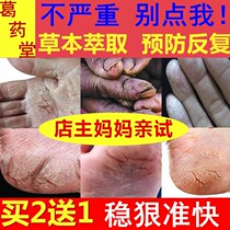 Hand crack cream dry crack repair cream healing cream anti-hand crack special effect adult repair cracking dry crack cream