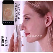 Visual blackhead instrument beauty household electric acne facial deep pore cleaner suction blackhead artifact