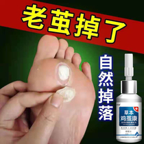 Chicken cocoon foot calcoon calcoon calcoon removal of cocoon paste special artifact dead skin softener hand and foot Cocoon