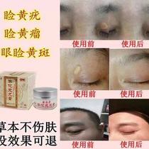 Round cream Eyelid orbital tumor Periorbital ointment Periorbital eyelid macular eyelid xanthoma eyelid yellow treatment tumor wart tumor Round