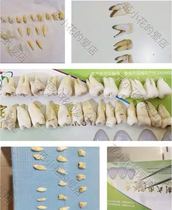 Detached teeth real teeth pulp preparation root canal treatment examination complete non-destructive and caries-free skills operation