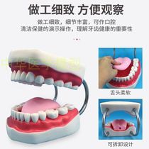 Tooth Model False Tooth Oral Teaching Pendulum Piece Kindergarten Dental Spare Tooth Detachable Oral Teaching Soft Gums