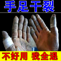 Winter hand cracking ointment hand cream hand cracking hand cream hand cracking foot cream spirit artifact hand crack dry crack repair cream