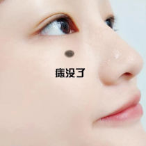 2021 good things recommended to remove black spots on the face where to buy 2 get 1