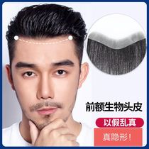 Real Hair Hairline m-type Forehead Hair Patch Wig for Men Hair Loss Bio Wig Patch Fake Bangs Hair Patch Block for Women
