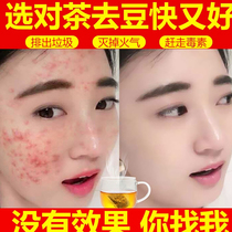 Pimples beauty conditioning endocrine acne acne dampness tea dandelion tea bag heat internal Tea