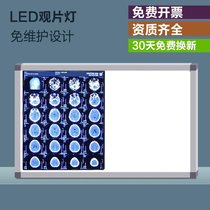 Film reading lamp Hospital x-ray film viewing lamp Ultra-thin led dental film viewing light box Hospital orthopedic double triple