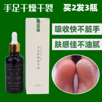 Zhongyitang hand and foot care solution is cracking