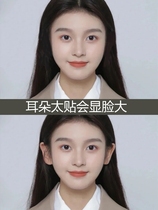 Genie ear deity styling ear stickup veneered deity Ears Straightener Invisible large face Invisible Large-Face Breeze Ear Deity