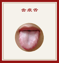 Conditioning Yangxu tooth marks tongue and tooth marks afraid of cold and dreaming easy to wake up clear water body sweating spleen and stomach health tea for men and women