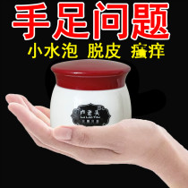 jiao qi gao antipruritic peeling sterilization bad feet zhi gen artifact fungi blisters feet peeling itch cream jiao qi yao