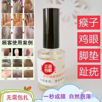 Tianjin delivery university products Super 15ml remove wart corns eye foot pads various warts