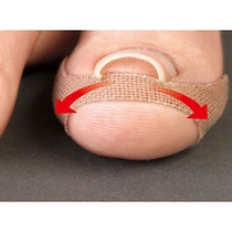 Spot Japanese made to prevent nail embedded patch disposable toenails do not hurt